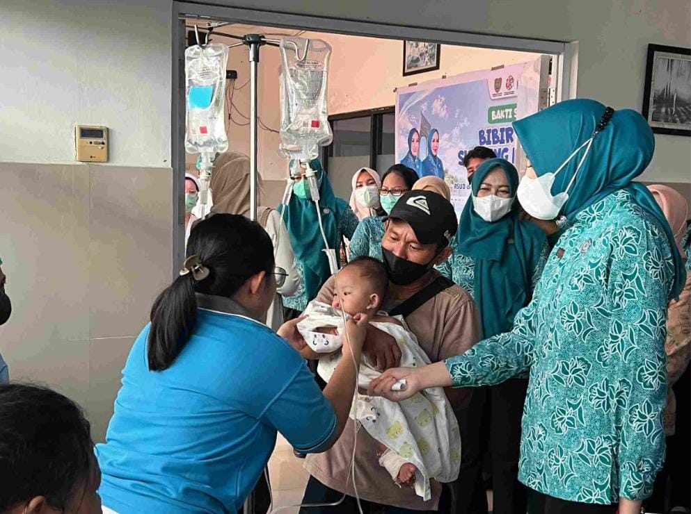 Ketika Operasi Bibir Sumbing Ubah Harapan Jadi Senyuman