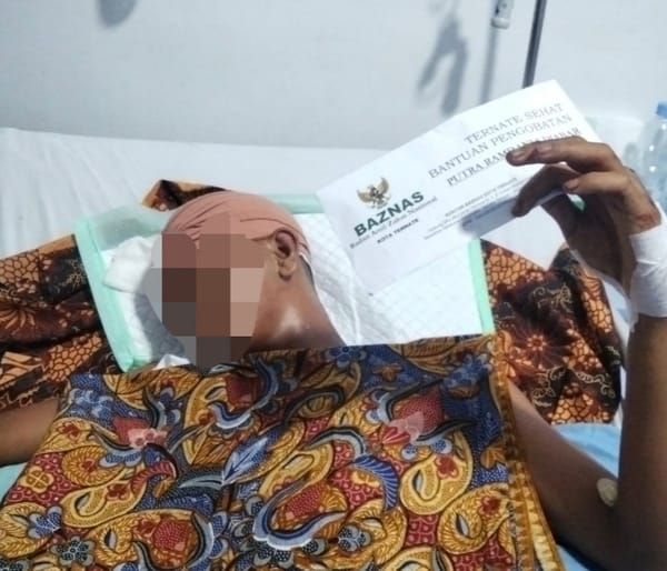 BAZNAS Bantu Korban Kecelakaan Lewat Program Ternate Sehat